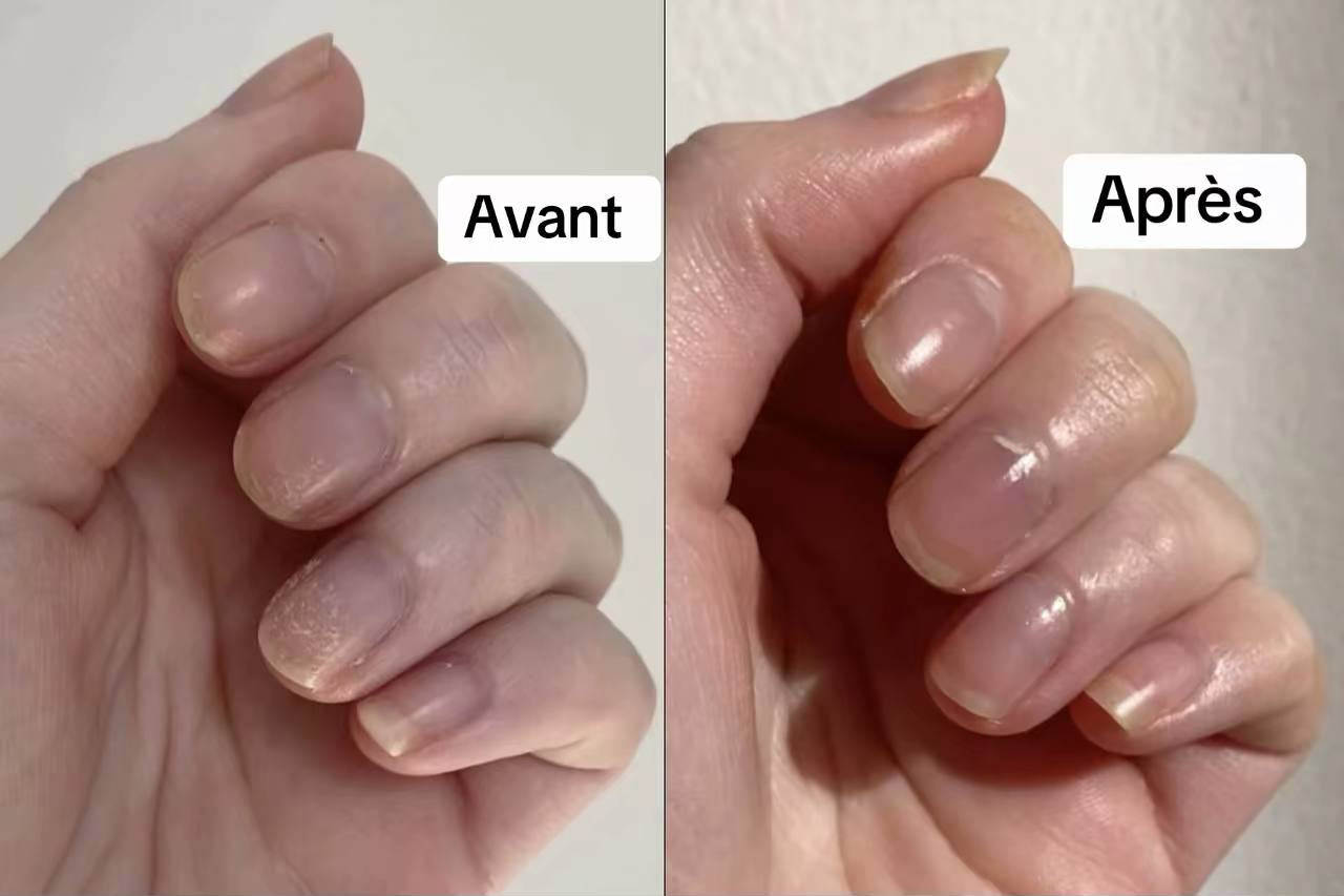 AP_ongles.jpg