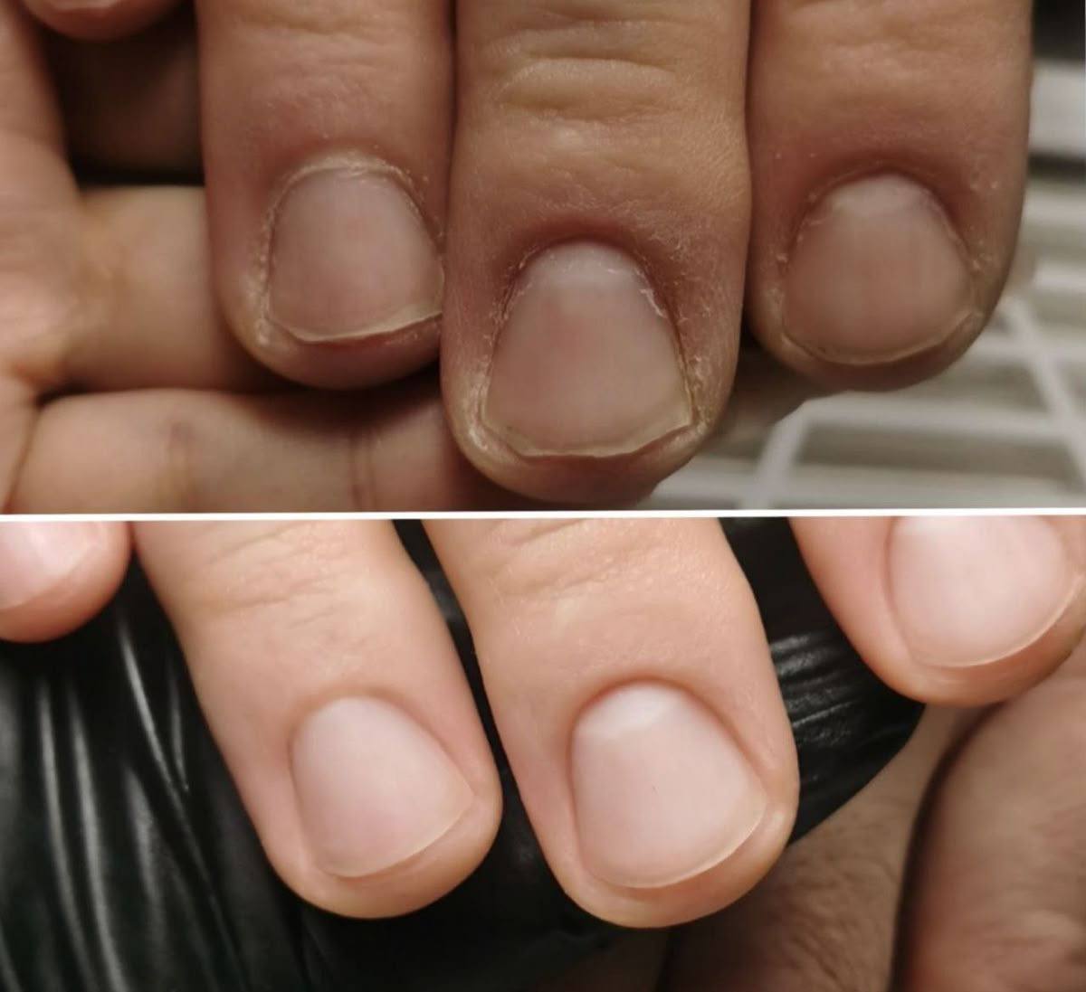 Ongles_AP.jpg
